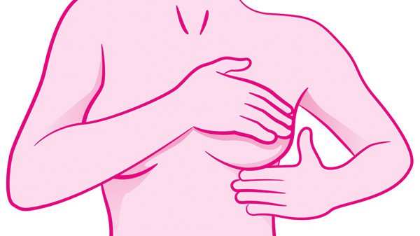 Mitos sobre câncer de mama