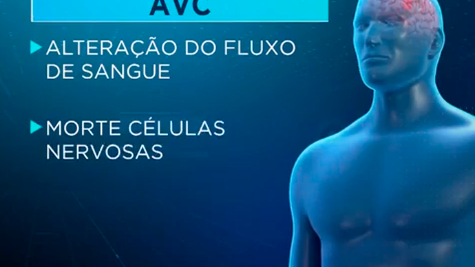 AVC mata