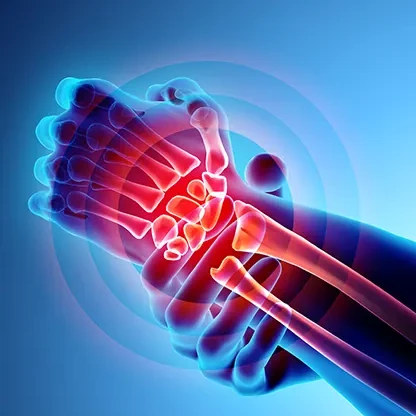Cirurgia da Mão